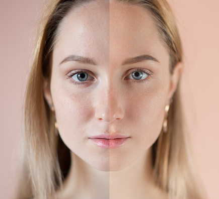 Beauty concept - retouch before and after. Beautiful woman with blue eyes.