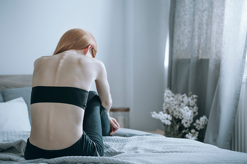 Mujer con anorexia en cama photo