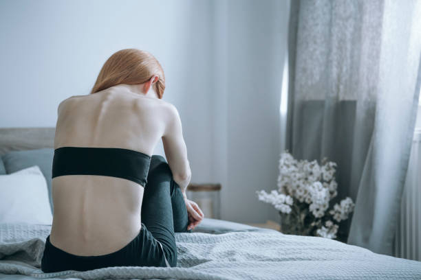 mujer con anorexia en cama - de bajo peso fotos fotografías e imágenes de stock