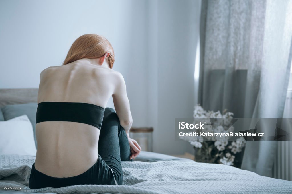 Woman with anorexia on bed Young woman with anorexia sitting alone on bed and feeling unhappy. Anorexia problem concept Anorexia Nervosa Stock Photo