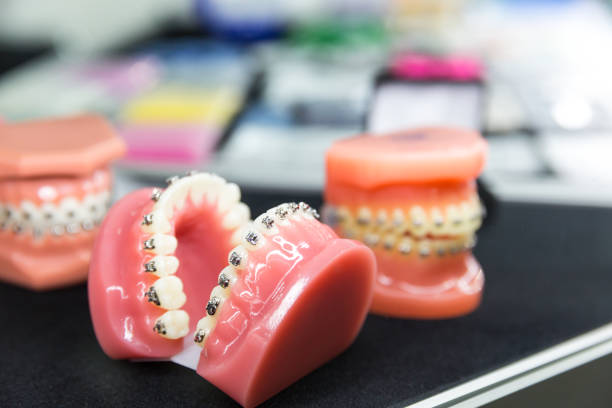 istock Dental or orthodontic tools, denture closeup 866758164