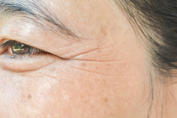 wrinkles on the eyes - wrinkles eyes imagens e fotografias de stock