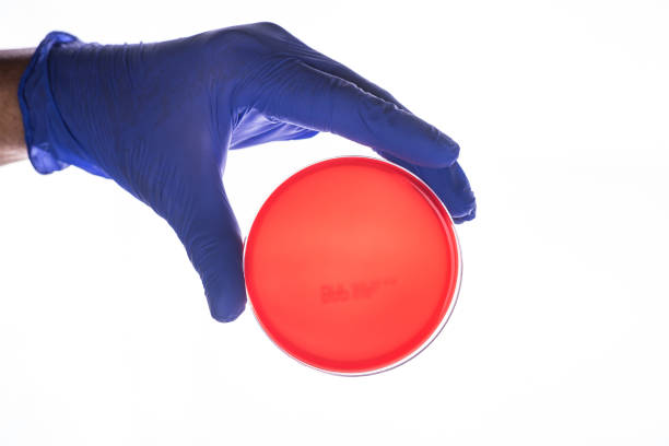 glove hand hold the blood petri dish macro shot - petri dish bacterium colony laboratory imagens e fotografias de stock