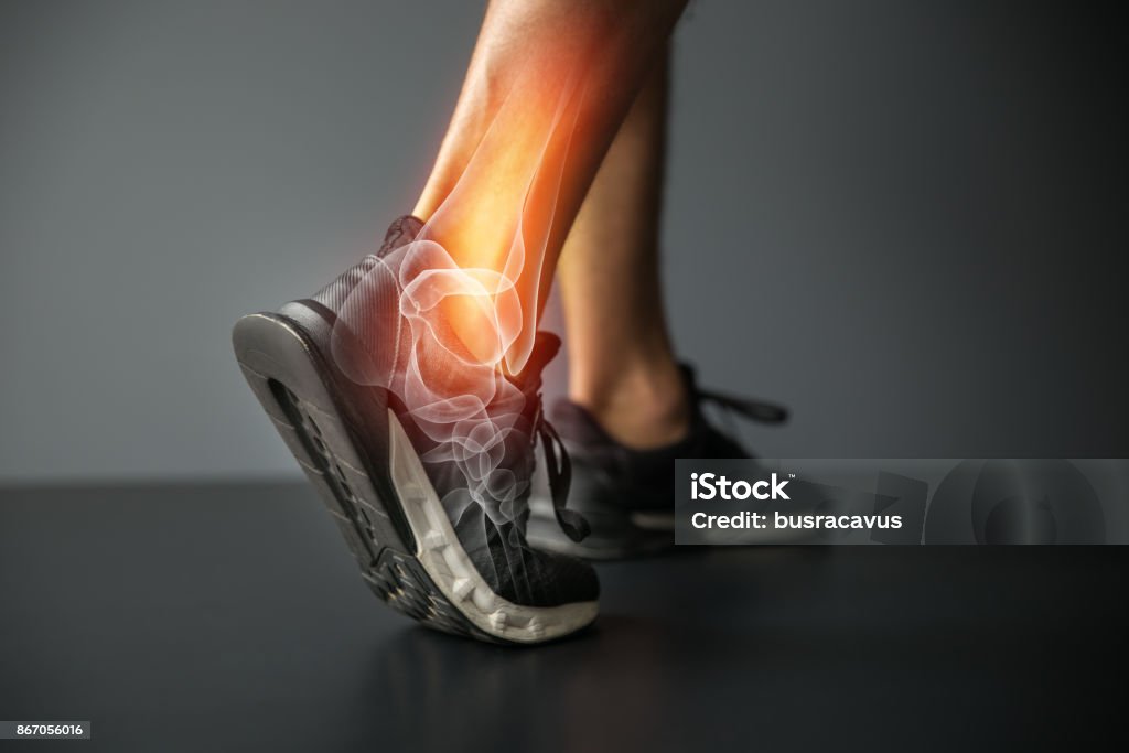 Lesión de tobillo y lesiones de articulaciones dolor-deportes - Foto de stock de Pie - Anatomía libre de derechos