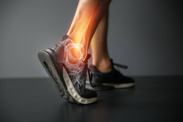 Ankle injury and Joint pain-Sports injuries Joint pain, sports injuries, At gym, damaged section, Sportsman, ankle sprain, sports accidents body part photos stock pictures, royalty-free photos & images