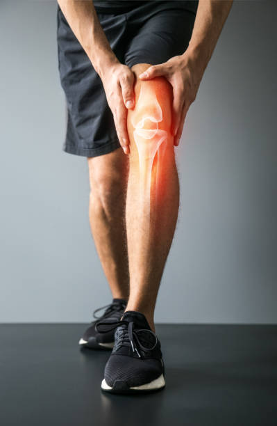 Knee trauma and joint pain-Sports injuries Joint pain, sports injuries, At gym, damaged section, Sportsman, knee bone injury, sports accidents joint pain stock pictures, royalty-free photos & images