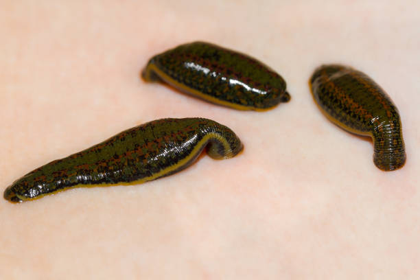 Medicinal Leechhirudo Stock Photo - Download Image Now - Bloodsucking, Leech, Animal - iStock Medicinal Leechhirudo Stock Photo - Download Image Now - Bloodsucking, Leech, Animal - iStock