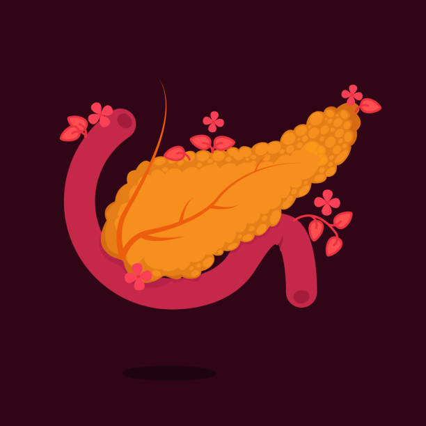 Pancrease Cancer Clip Art Pancreatic Cancer Symbols Cartoon Illustrations, Royalty-Free Vector ...