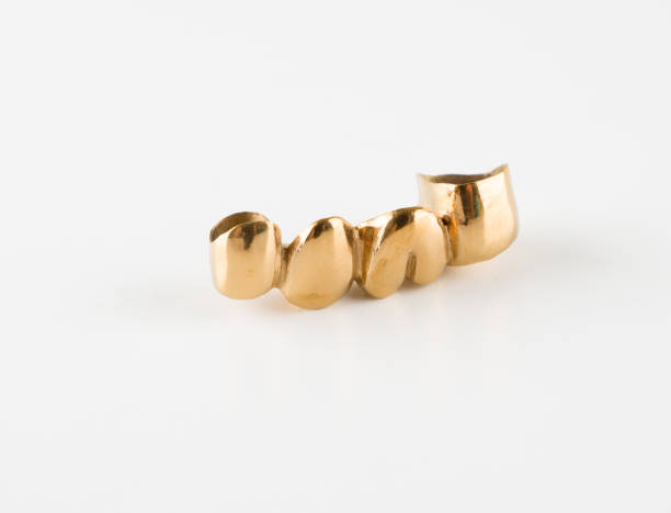 istock Artificial teeth made of steel 867863162