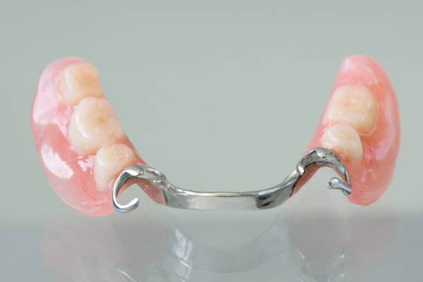 Clasp denture with a metal arc Clasp denture with a metal arc and artificial teeth incomplete stock pictures, royalty-free photos & images
