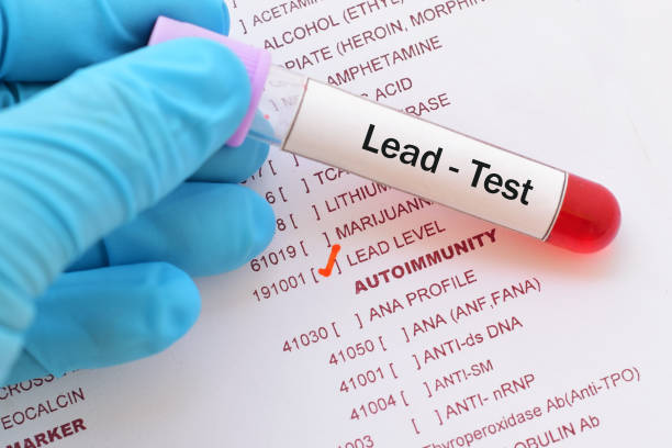 Lead (Pb) test Blood sample with requisition form for lead (Pb) test graphite stock pictures, royalty-free photos & images