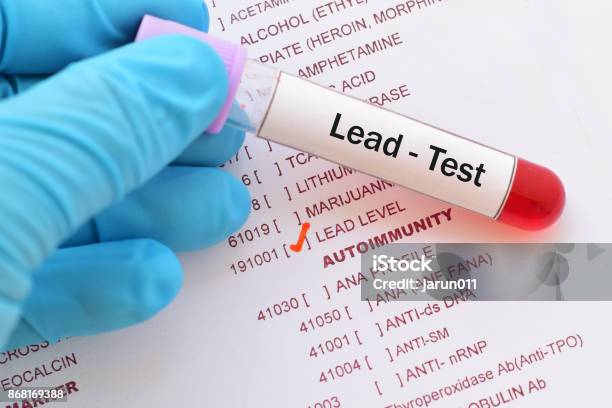 Lead Test Stock Photo - Download Image Now - Lead, Medical Test, Poisonous