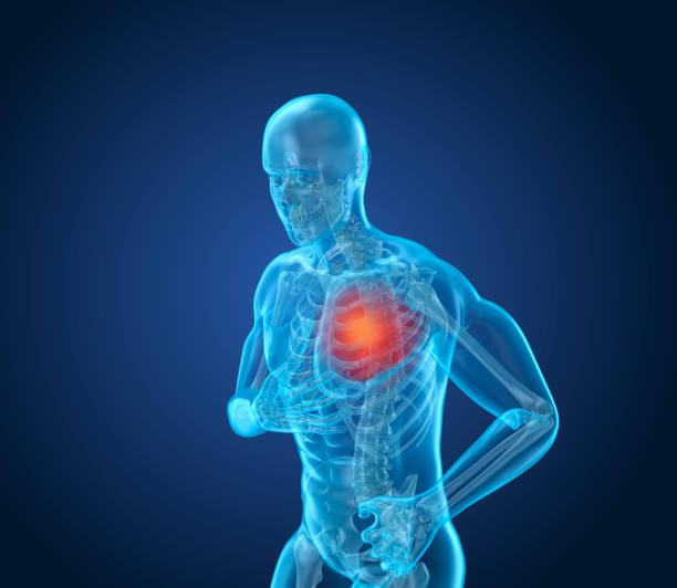 istock Heart Attack, man suffering from heart pain. 3D illustration 868425388