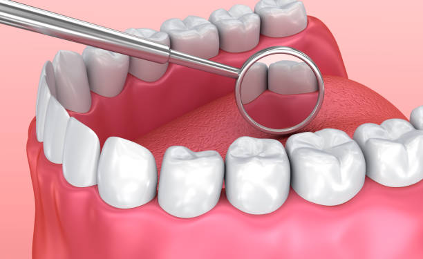 Teeth inspection with mirror. Medically accurate tooth 3D illustration Teeth inspection with mirror. Medically accurate tooth 3D illustration boreray and stac lee stock pictures, royalty-free photos & images