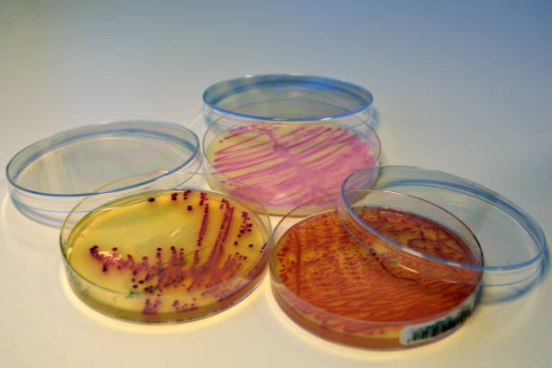 항생제 내성 superbugs - hospital acquired infection 뉴스 사진 이미지