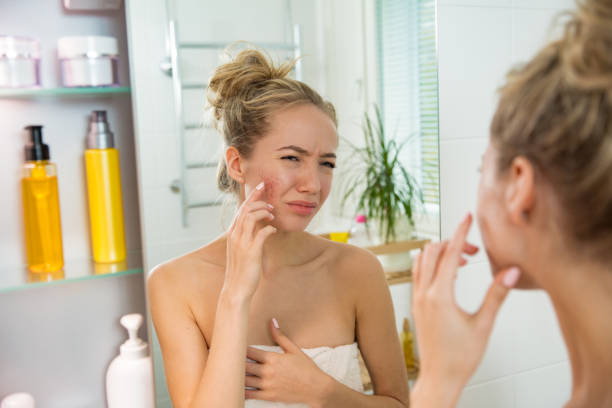 Young beautiful woman with dry irritated skin. stock photo