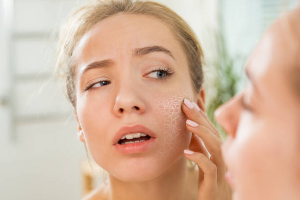 Young beautiful woman with dry irritated skin. Young beautiful woman touching skin in bathroom. Unhappy girl standing in towel, looking in the mirror, checking dry irritated skin. Morning skincare routine. skin stock pictures, royalty-free photos & images