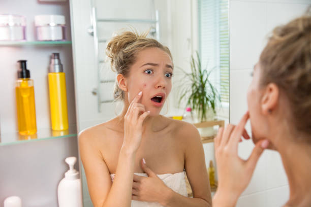 istock Young beautiful woman with pimple 869378706