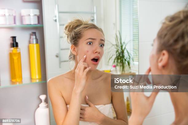Young Beautiful Woman With Pimple Stock Photo - Download Image Now - Acne, Pimple, Human Face