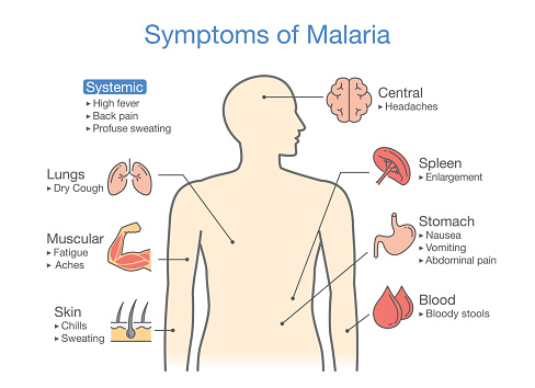 Diagram for patient with Malaria symptoms appear. Illustration about medical and health.