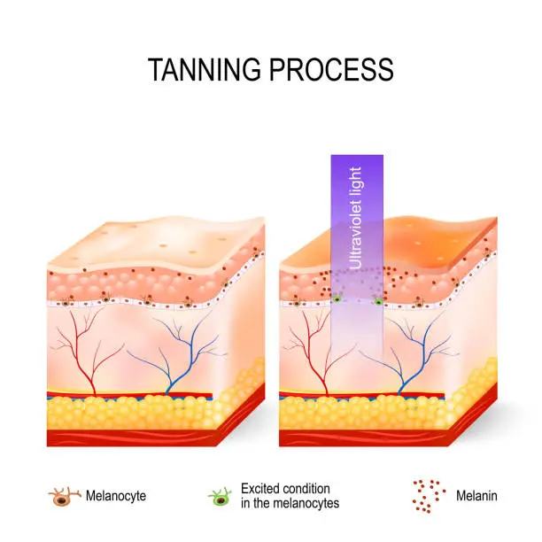 Vector illustration of Tanning process.