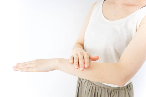 istock woman handcare 869973888