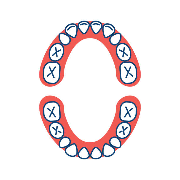 milchzahn diagramm baby mund. childs kiefer, milchzähne, milchzähne oder milchzähne. kinder-zahnmedizin-übersicht-symbol - milchzahn stock-grafiken, -clipart, -cartoons und -symbole