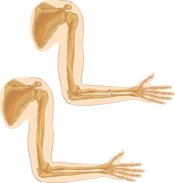 biała ilustracja wektorowa tła kości ramiennej - arm bone stock illustrations