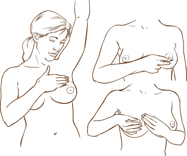 illustrations, cliparts, dessins animés et icônes de illustration vectorielle d’un examen de cancer du sein - covered nudity