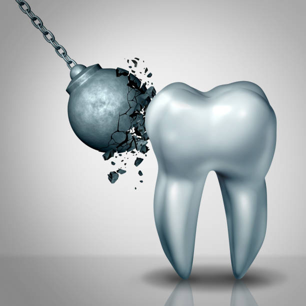 Strong Tooth Enamel Strong tooth enamel and teeth strength dental or dentistry  symbol as awrecking ball being demolished by a solid white molar as a medicine concept as a 3D render. tooth enamel stock pictures, royalty-free photos & images