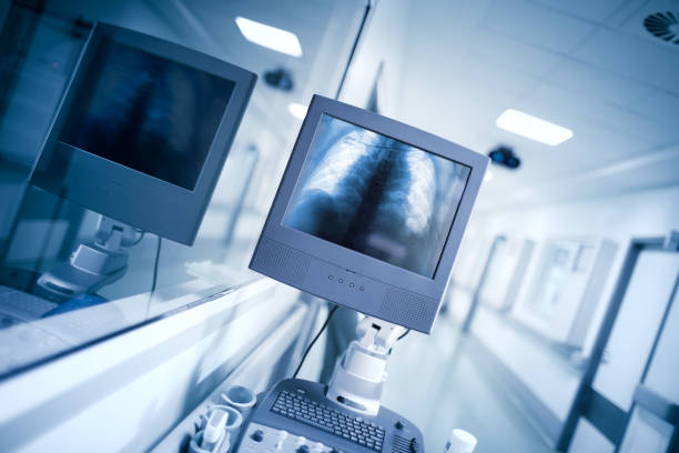 istock Examination equipment in hospital hall wih an x-ray image 871335618