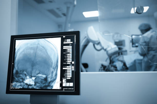 scansione a raggi x del cervello dei pazienti durante l'intervento chirurgico - doctor brain x ray x ray image foto e immagini stock