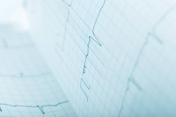 istock ECG paper record, medical background 871336010