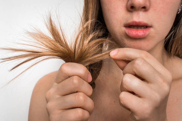 髪の問題 - 脆性、破損、乾燥と損失の髪のコンセプト - brittlebush ストックフォトと画像