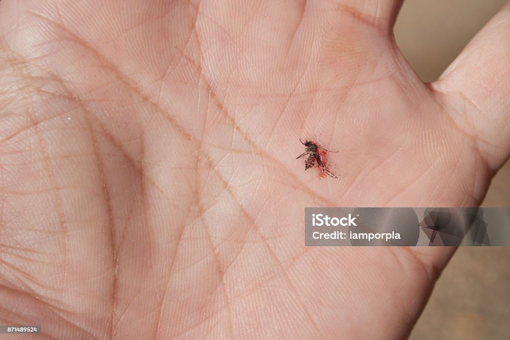 mosquitoes die in male hand mosquito die have blood in human hand.he hit it.mosquito feeding on a human hand. Adult Stock Photo