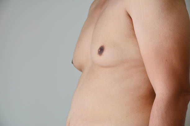 close up men boob fat man close up men boob fat man gynecomastia stock pictures, royalty-free photos & images