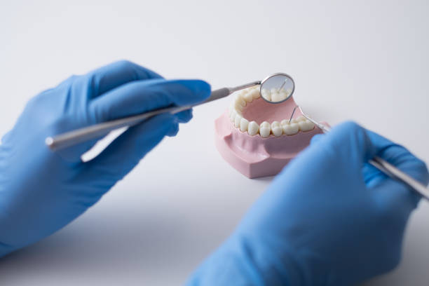 istock Dental examination on mouth model close-up 871573274