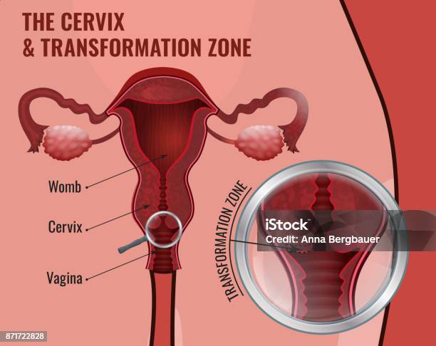 Cervical Screening Image Stock Illustration - Download Image Now - Cervix, Uterus, Human Papilloma Virus