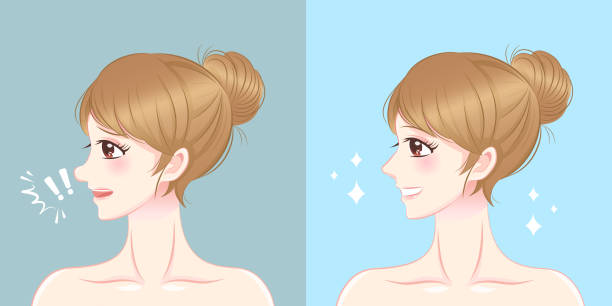 illustrazioni stock, clip art, cartoni animati e icone di tendenza di cartone animato donna chirurgia del naso - nose job illustrations