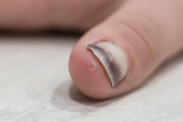 istock Beaten thumb nail 872402458