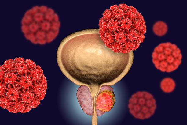 Conceptual image for viral ethiology of prostate cancer Conceptual image for viral ethiology of prostate cancer. 3D illustration showing Human Papilloma Viruses HPV infecting prostate gland which develops cancerous tumor prostate gland stock pictures, royalty-free photos & images