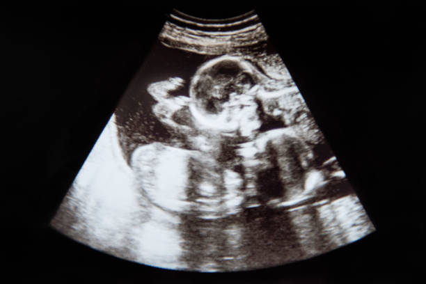 baby ultrasound identical twins - yin yang symbol fotos imagens e fotografias de stock