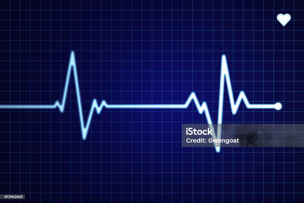 Electrocardiogram - Photo de Rythme cardiaque libre de droits