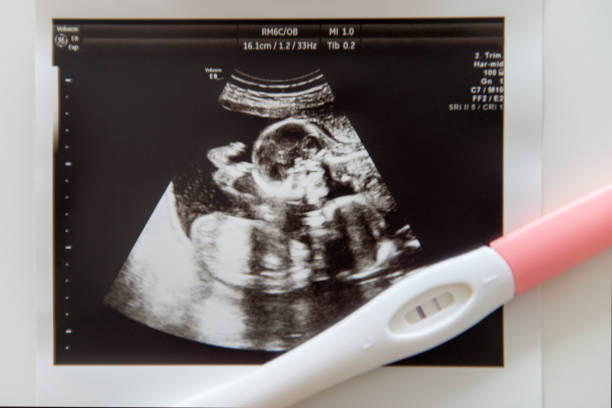 istock Positive pregnancy test with ultrasound picture 873241432