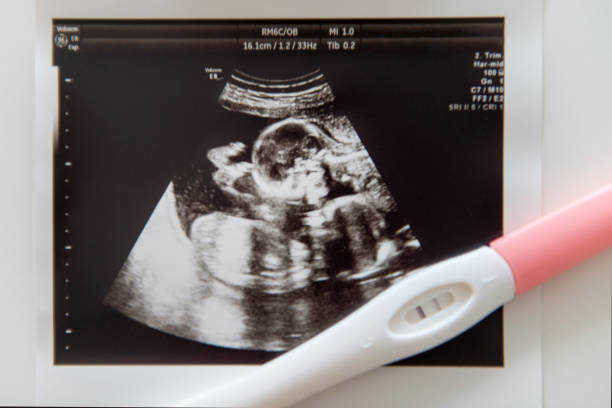 Positive pregnancy test with ultrasound picture Positive pregnancy test on ultrasound showing twins uterus photos stock pictures, royalty-free photos & images