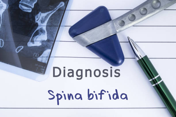 diagnose von spina bifida. medizinische geschichte geschrieben mit diagnose spina bifida, mri bild sakraler wirbelsäule und neurologische hammer. medizinisches konzept für neurologie, neurologie, neurochirurgie - wirbelkanal stock-fotos und bilder