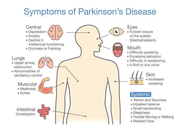 stockillustraties, clipart, cartoons en iconen met parkinson's disease symptomen en tekenen. - parkinson