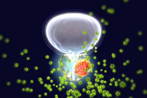 Conceptual image for viral ethiology of prostate cancer Conceptual image for viral ethiology of prostate cancer. 3D illustration showing viruses infecting prostate gland which develops cancerous tumor prostate cancer stock pictures, royalty-free photos & images