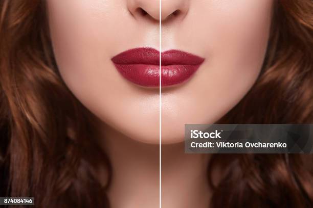Before And After Lip Filler Injections Fillers Lip Augmentation Beautiful Perfect Lips Sexy Mouth Close Up Beauty Young Woman Lips With Red Lipstick Stock Photo - Download Image Now