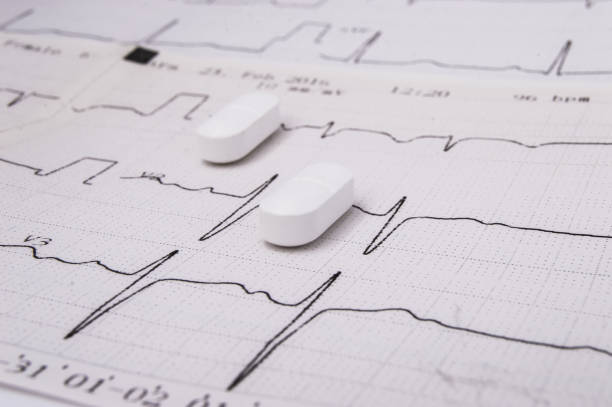 White oblong pills or tablets (for treatment of diseases of the cardiovascular system as an option - statin) lie on the paper electrocardiogram (EKG or ECG)
